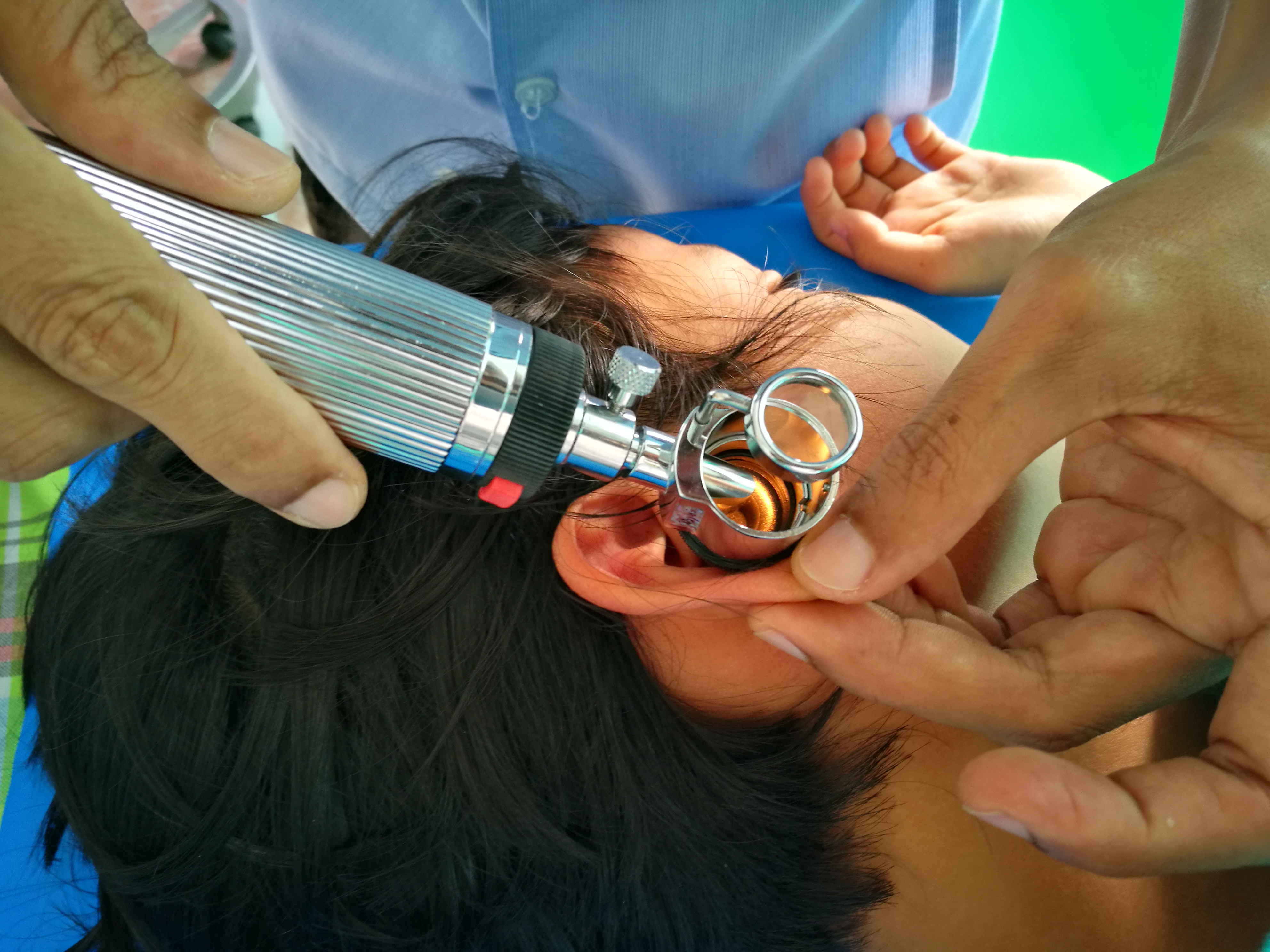 Micro Ear Surgery